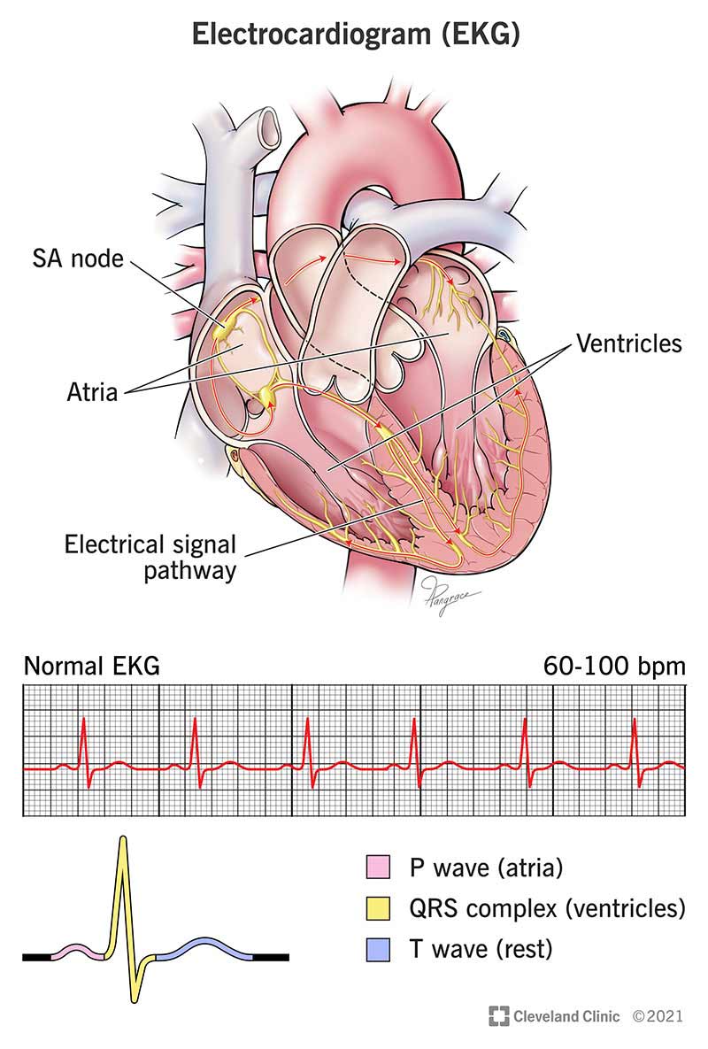 ECG i n T m N i L n i u G 